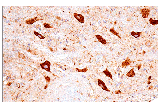 Immunohistochemistry Image 15: SDHB (E3H9Z) Rabbit Monoclonal Antibody