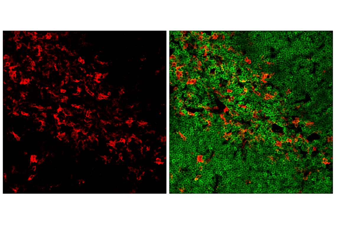 Immunofluorescence Image 3: CD11c (D1V9Y) Rabbit Monoclonal Antibody (Alexa Fluor<sup>®</sup> 647 Conjugate)