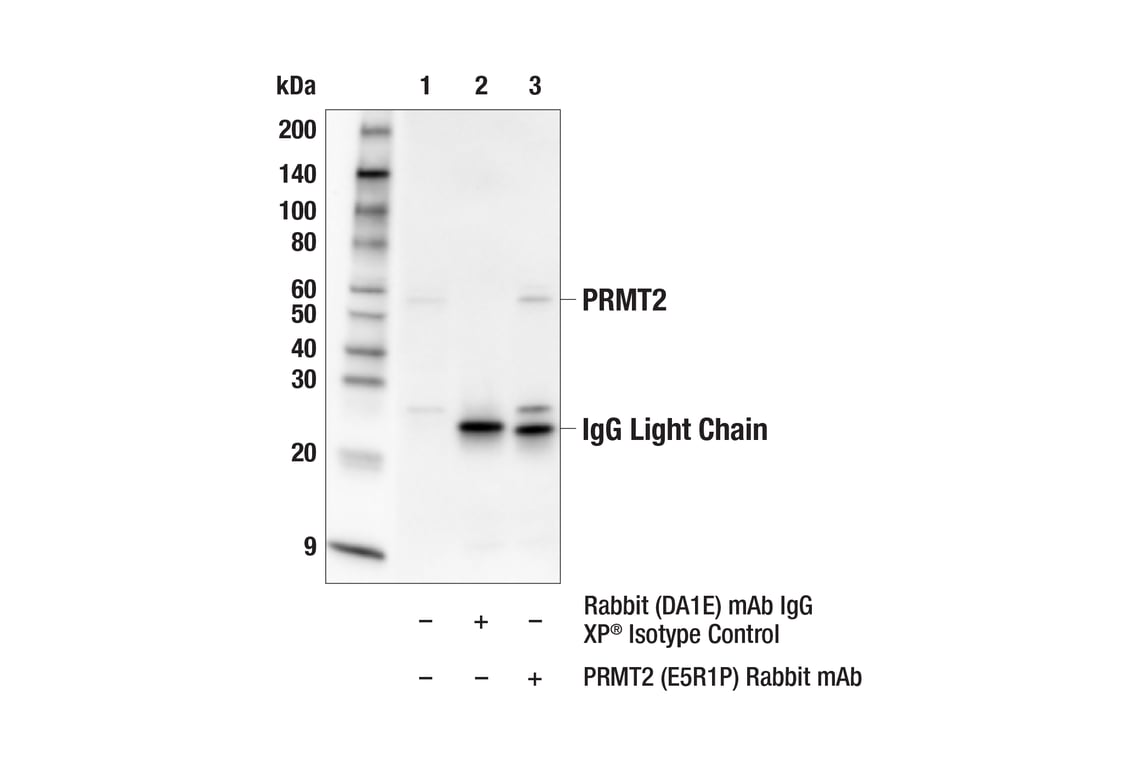 undefined Image 18: PRMT Antibody Sampler Kit