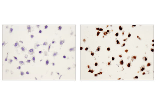 Immunohistochemistry Image 4: Phospho-Stat1 (Tyr701) (58D6) Rabbit Monoclonal Antibody (BSA and Azide Free)