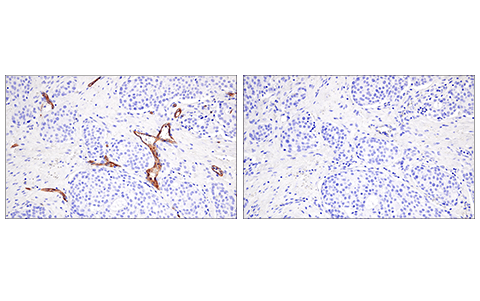 Immunohistochemistry Image 4: CD200 (E5I9V) Rabbit Monoclonal Antibody (BSA and Azide Free)