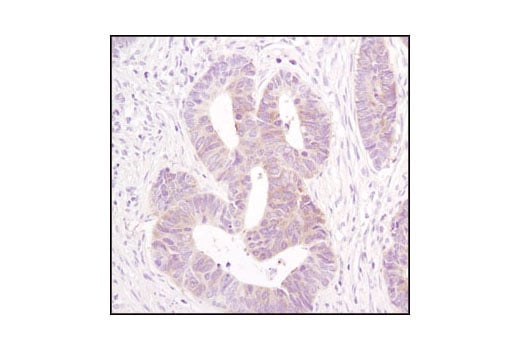 Immunohistochemistry Image 3: Acetyl-CoA Carboxylase (C83B10) Rabbit Monoclonal Antibody (BSA and Azide Free)