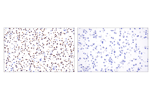Immunohistochemistry Image 2: HPK1 (E1C3L) Rabbit Monoclonal Antibody