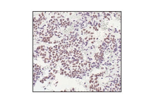 undefined Image 21: HSP/Chaperone Antibody Sampler Kit