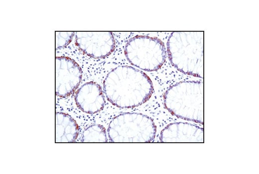 Immunohistochemistry Image 2: EpCAM (VU1D9) Mouse mAb
