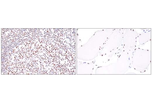 Immunohistochemistry Image 6: USP39 (E8U2M) Rabbit Monoclonal Antibody