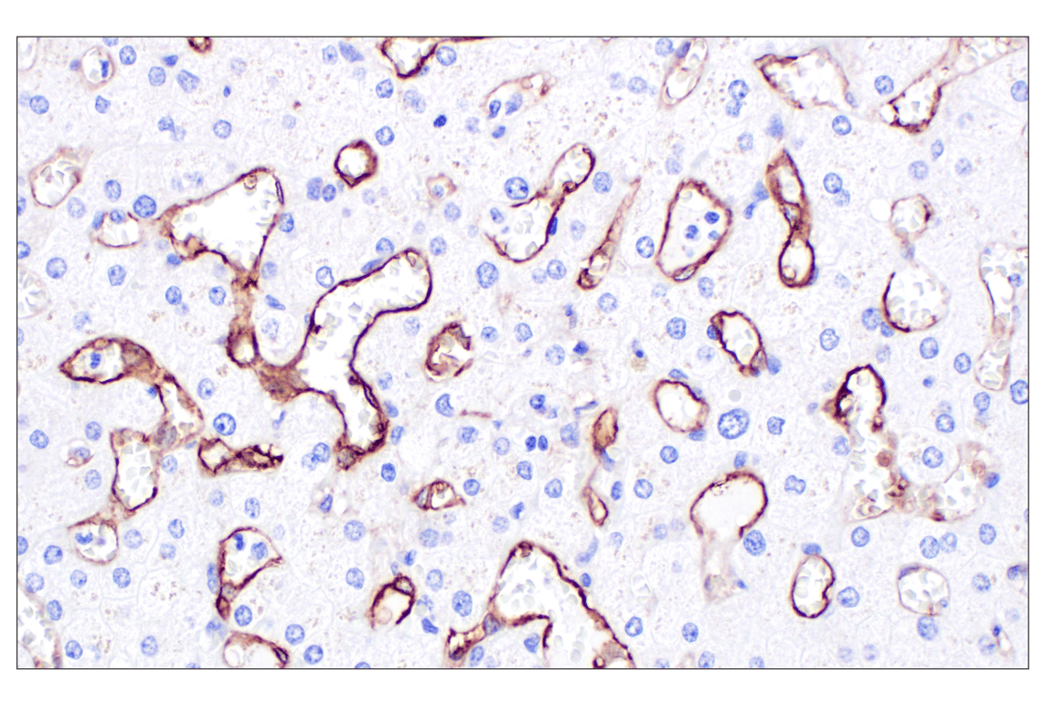 Immunohistochemistry Image 7: CD105/Endoglin (F9C5Q) Rabbit Monoclonal Antibody