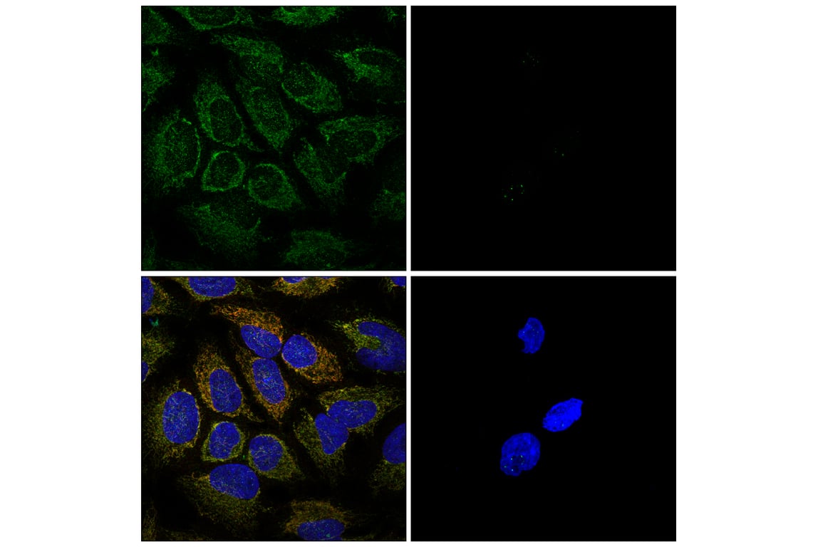 Immunofluorescence Image 2: TIM23 (E1Q7L) Rabbit Monoclonal Antibody