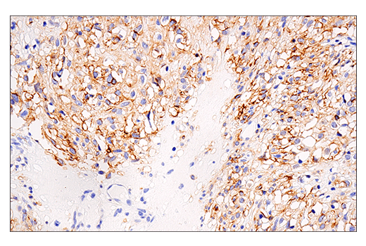 Immunohistochemistry Image 4: NCAM1 (CD56) (E7X9M) Rabbit Monoclonal Antibody