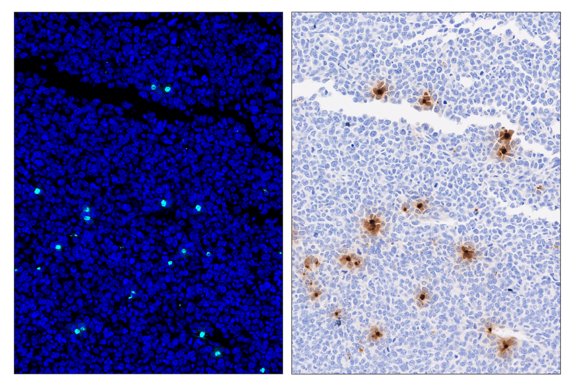 Immunohistochemistry Image 3: Eosinophil cationic protein (F3G7N) & CO-0230-488 SignalStar<sup>®</sup> Oligo-Antibody Pair