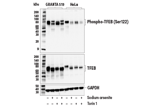 Western Blotting Image 3: Phospho-TFEB (Ser122) (E9M5M) Rabbit Monoclonal Antibody