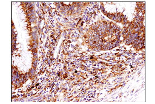 Immunohistochemistry Image 1: Grp94 (D6X2Q) Rabbit Monoclonal Antibody