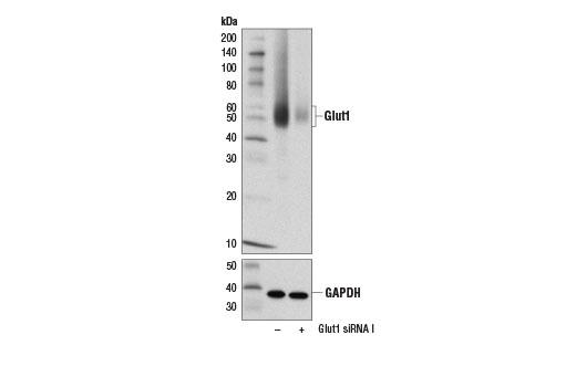 Western Blotting Image 2: Glut1 (D3J3A) Rabbit mAb