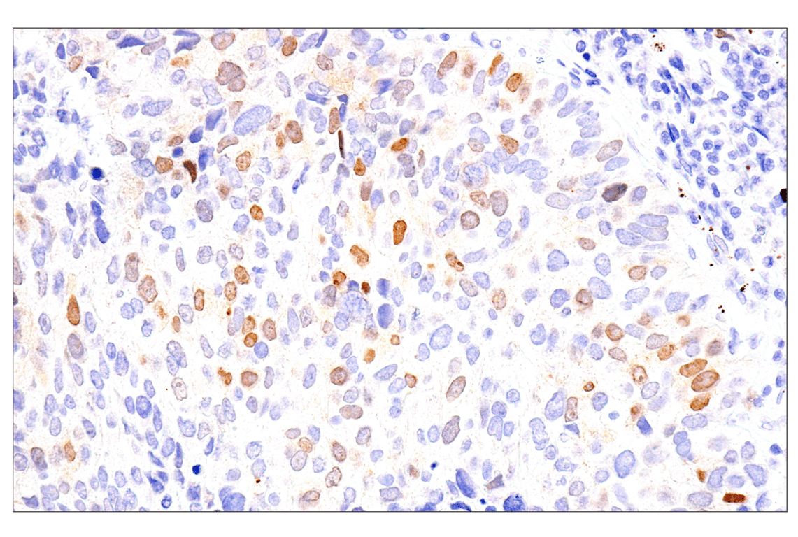 Immunohistochemistry Image 3: Chk1 (2G1D5) Mouse Monoclonal Antibody (BSA and Azide Free)