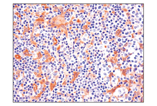 undefined Image 30: Human Reactive Inflammasome Antibody Sampler Kit II