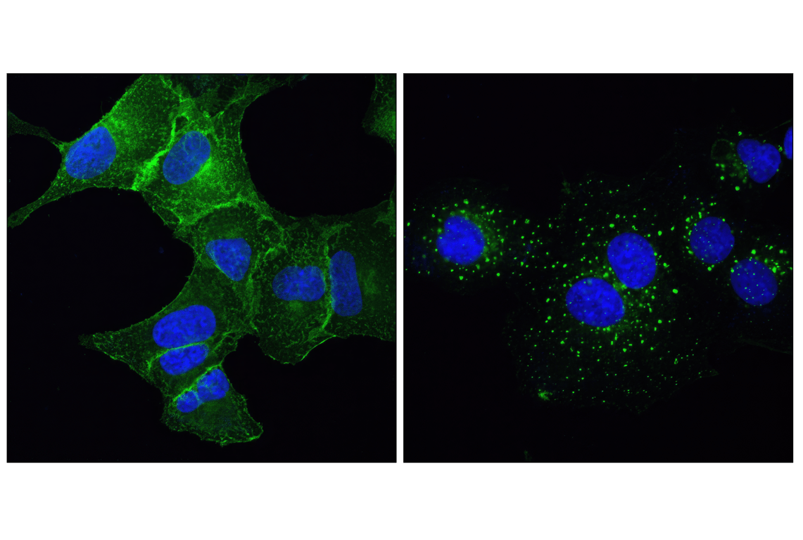 Immunofluorescence Image 1: EGF Receptor (D38B1) Rabbit Monoclonal Antibody (Alexa Fluor<sup>®</sup> 488 Conjugate)