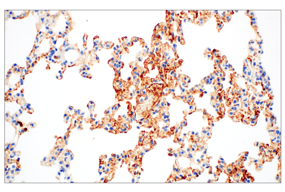 Immunohistochemistry Image 3: C1QB (E3U6X) Rabbit Monoclonal Antibody