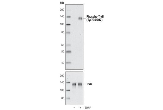 undefined Image 1: Human Brain-Derived Neurotrophic Factor (BDNF) Recombinant Protein