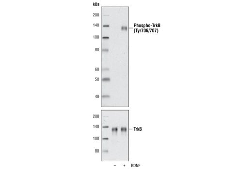 Human Brain-Derived Neurotrophic Factor (BDNF) Recombinant Protein: Image 1