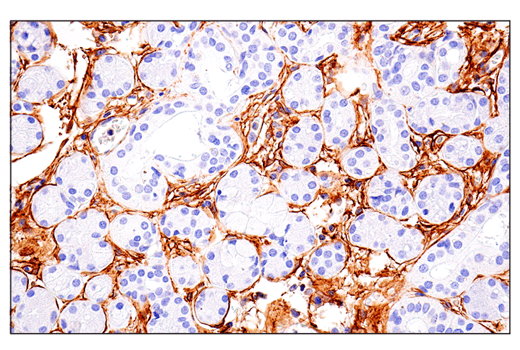 Immunohistochemistry Image 5: CD248 (E9Z7O) XP<sup>®</sup> Rabbit mAb (BSA and Azide Free)