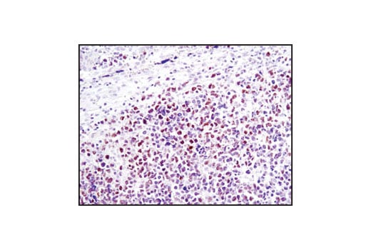 Immunohistochemistry Image 1: NUT (C52B1) Rabbit Monoclonal Antibody