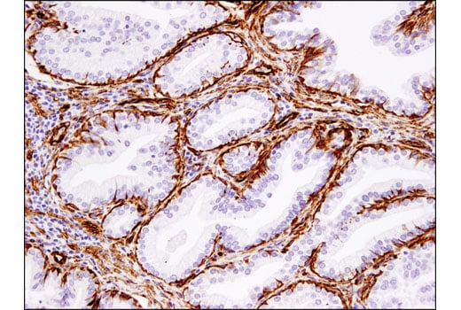 Immunohistochemistry Image 4: Cavin-1 (D1P6W) Rabbit Monoclonal Antibody