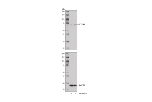 Western Blotting Image 4: SYVN1 (D3O2A) Rabbit Monoclonal Antibody