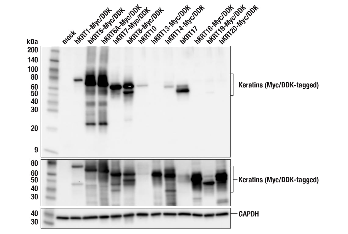 Western Blotting Image 2: Pan-Keratin (Type II) (F6G1P) Rabbit Monoclonal Antibody