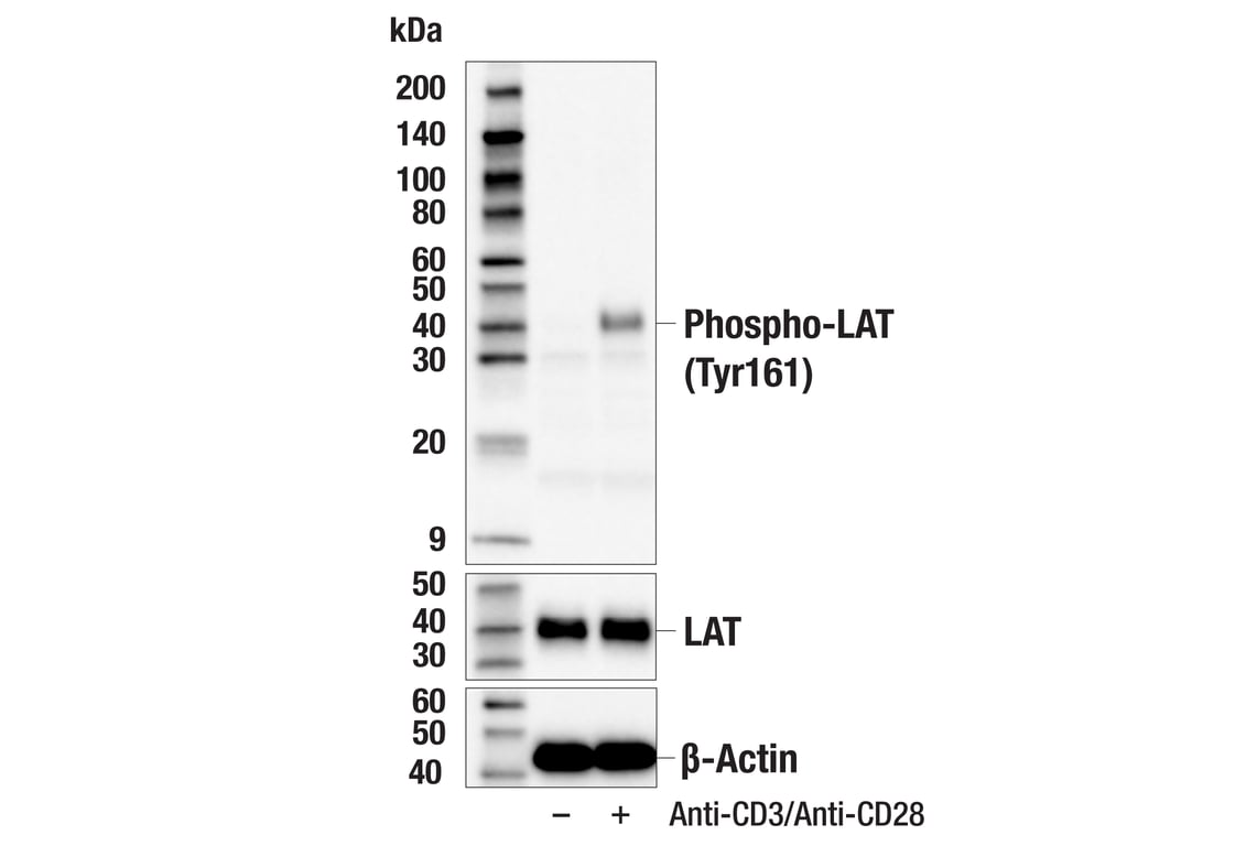 Phospho-LAT (Tyr161) (E9Q2R) Rabbit mAb | Cell Signaling