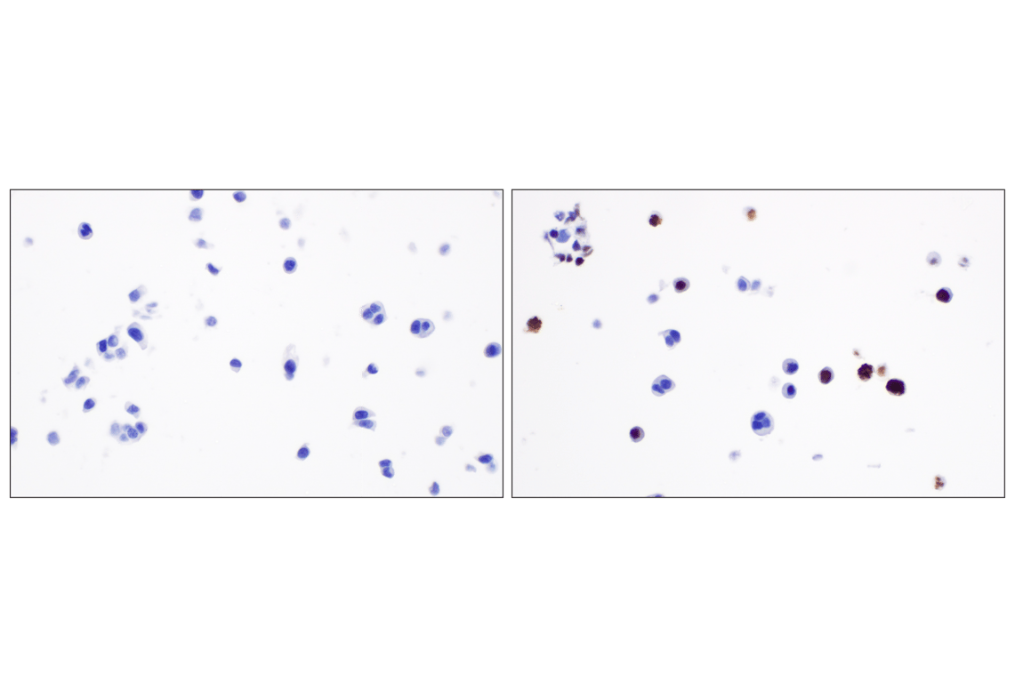 Immunohistochemistry Image 10: Phospho-Histone H3 (Ser10) (D7N8E) Rabbit Monoclonal Antibody (BSA and Azide Free)