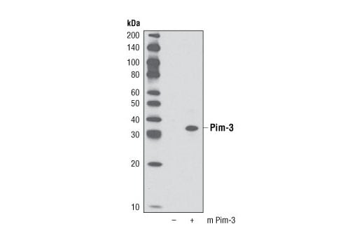 undefined Image 11: Pim Kinase Antibody Sampler Kit