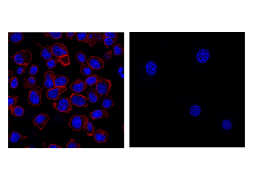 Immunofluorescence Image 1: PD-1 (Intracellular Domain) (D7D5W) XP<sup>®</sup> Rabbit mAb (Alexa Fluor<sup>®</sup> 555 Conjugate)