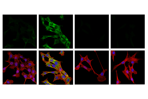 Immunofluorescence Image 1: Phospho-RIP (Ser321) (E9K2A) Rabbit Monoclonal Antibody