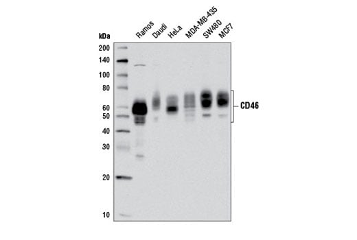 Western Blotting Image 1: CD46 (D6N7H) Rabbit mAb