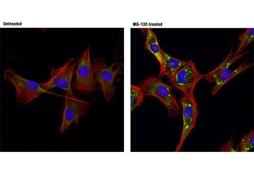 Immunofluorescence Image 1: FXR1 (D10A2) Rabbit Monoclonal Antibody