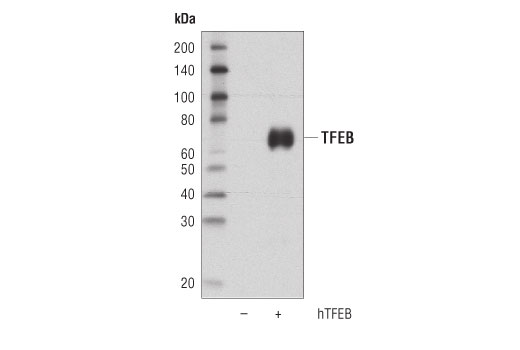 Western Blotting Image 2: TFEB (D2O7D) Rabbit Monoclonal Antibody (BSA and Azide Free)