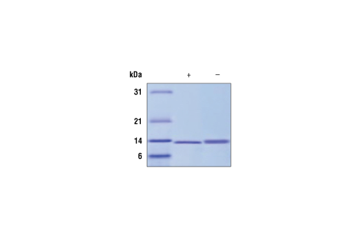 undefined Image 2: Human IL-2 Recombinant Protein