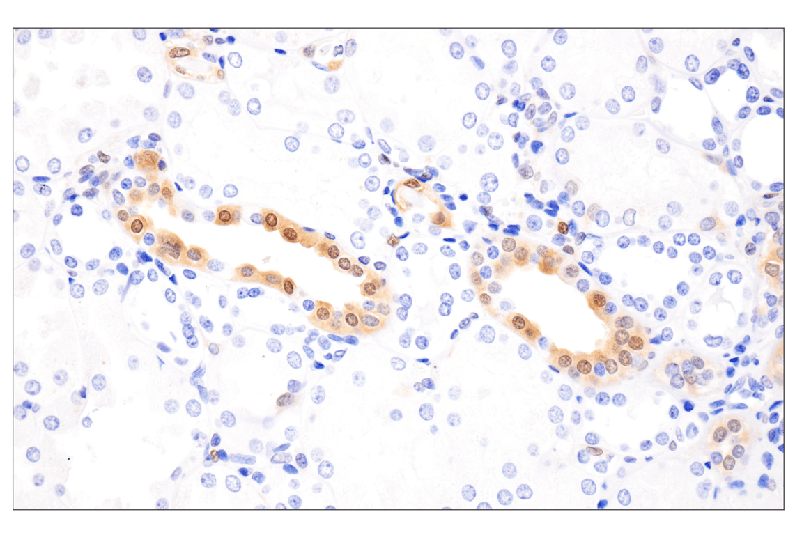 Immunohistochemistry Image 10: Phospho-Stat3 (Ser727) (D4X3C) Rabbit Monoclonal Antibody