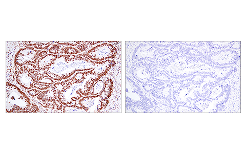 Immunohistochemistry Image 2: 53BP1 (E7N5D) Rabbit Monoclonal Antibody (BSA and Azide Free)