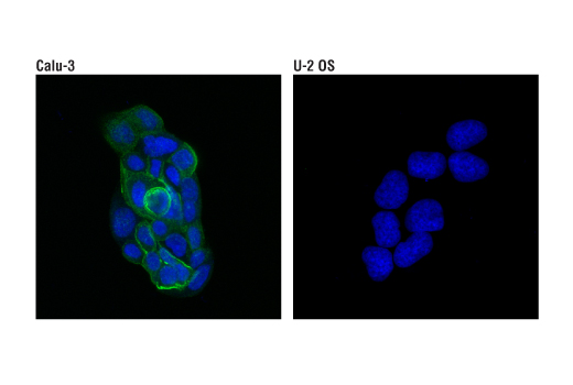 Immunofluorescence Image 1: CFTR (D6W6L) Rabbit Monoclonal Antibody (BSA and Azide Free)
