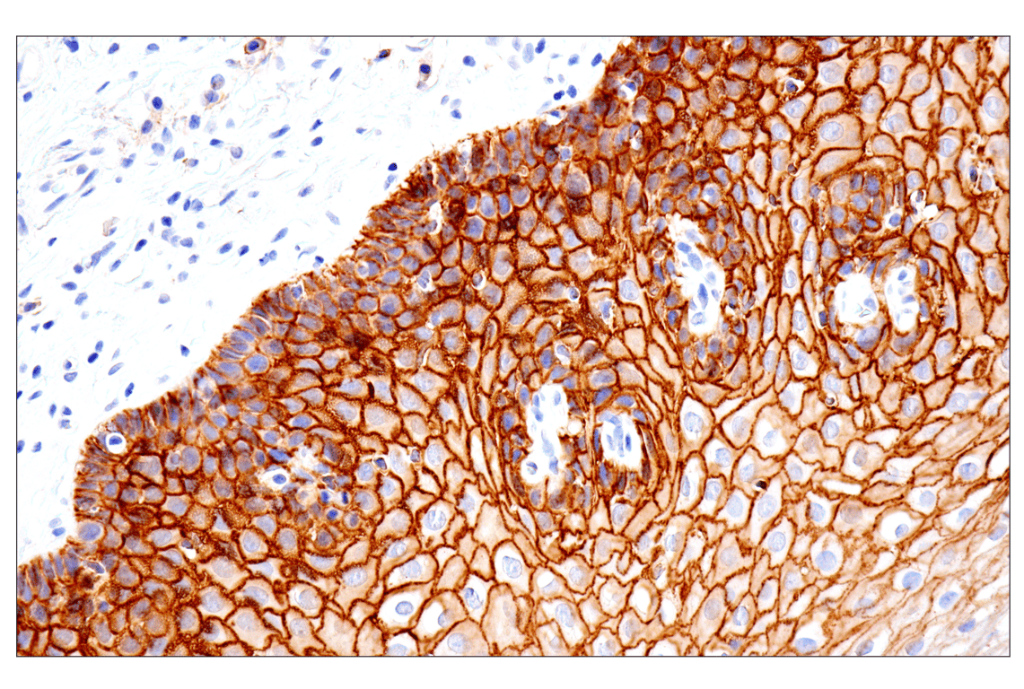 agt様 Anti-Zika virus NS1 protein antibody (GTX133307) | GeneTex
