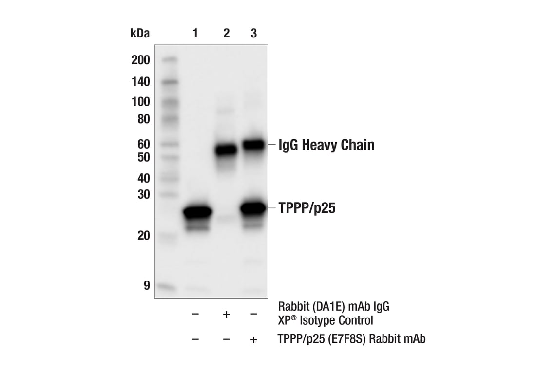 Immunoprecipitation Image 1: TPPP/p25 (E7F8S) Rabbit Monoclonal Antibody