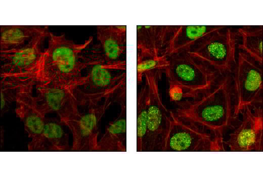 Immunofluorescence Image 1: RPA70/RPA1 (4D9) Rat Monoclonal Antibody