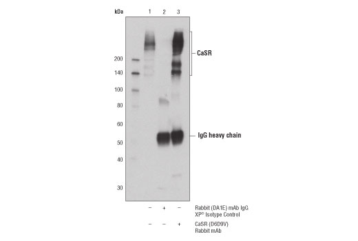 Immunoprecipitation Image 1: CaSR (D6D9V) Rabbit Monoclonal Antibody