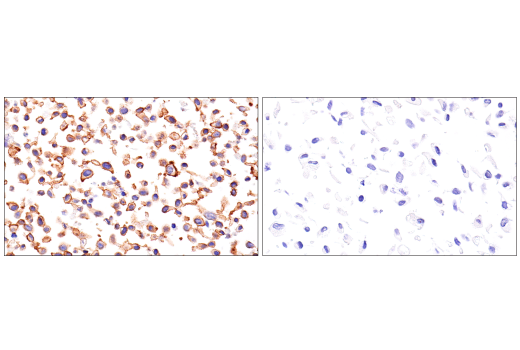 Immunohistochemistry Image 1: beta-Catenin (15B8) Mouse Monoclonal Antibody