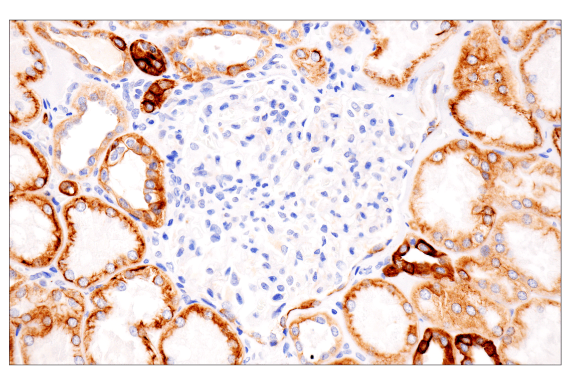 Immunohistochemistry Image 10: Pan-Keratin (Type II) (F6G1P) Rabbit Monoclonal Antibody