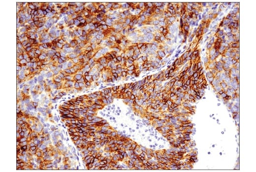 Immunohistochemistry Image 1: EpCAM (E6V8Y) Rabbit Monoclonal Antibody (BSA and Azide Free)