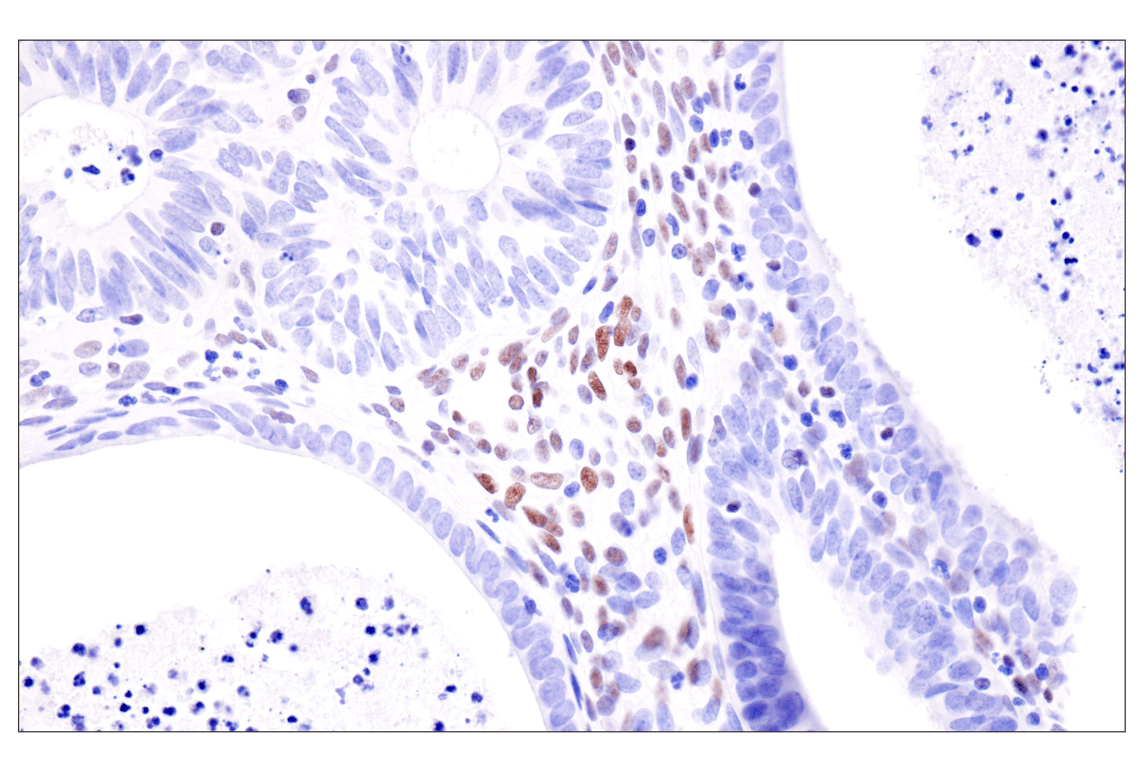 Immunohistochemistry Image 4: ADAR2 (F6U8S) Rabbit Monoclonal Antibody