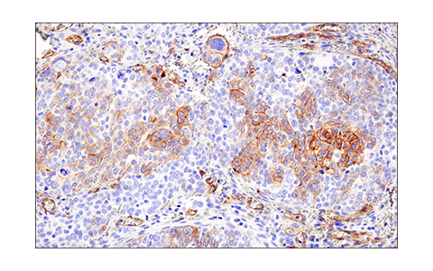 Immunohistochemistry Image 1: CD200 (E5I9V) Rabbit Monoclonal Antibody (BSA and Azide Free)