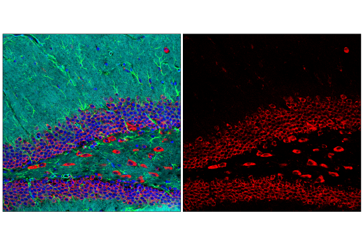 Immunofluorescence Image 1: YTHDF2 (E2I2H) Rabbit Monoclonal Antibody